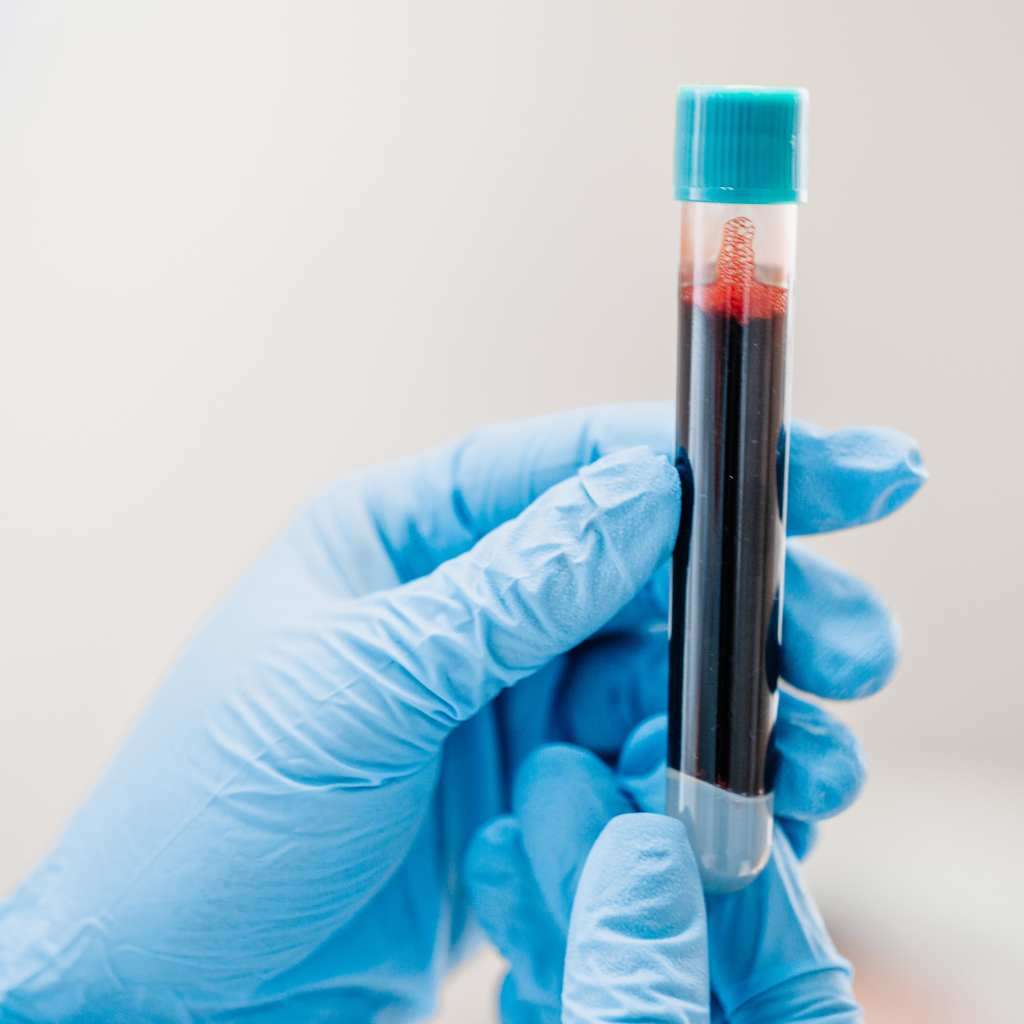Bryan Johnson e la Trasfusione di Sangue Multigenerazionale (2024) 2 Bryan Johnson e la Trasfusione di Sangue Multigenerazionale 1